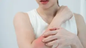 does oxycodone make you itch